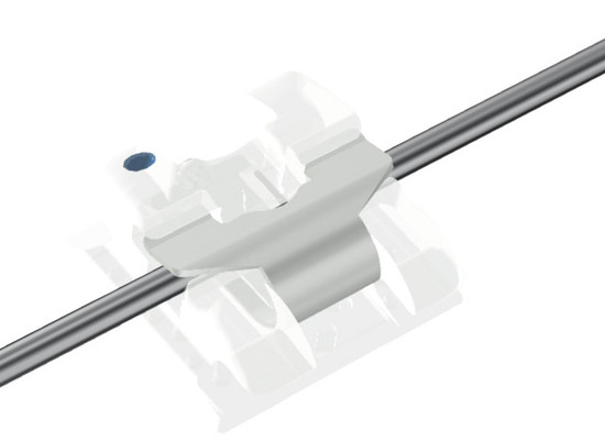 클리피씨 교정장치